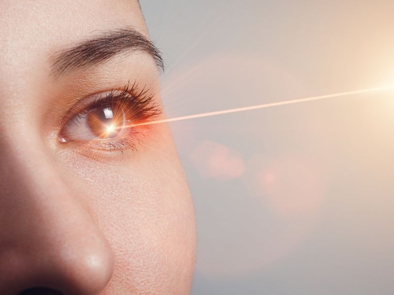 Trabeculoplastia Seletiva a Laser (SLT)